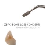 Zero bone loss concepts