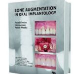 Bone augmenation in oral implantology