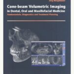 Cone-beam volumetric imaging in dental, oral and maxillofacial medicine : fundamentals, diagnostics and treatment planning