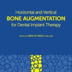 Horizontal and vertical bone augmentation for dental implant therapy
