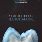 Posterior Direct Restorations
