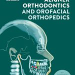 Aligner Orthodontics and Orofacial Orthopedics