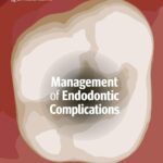 Management of Endodontic Complications From Diagnosis to Prognosis