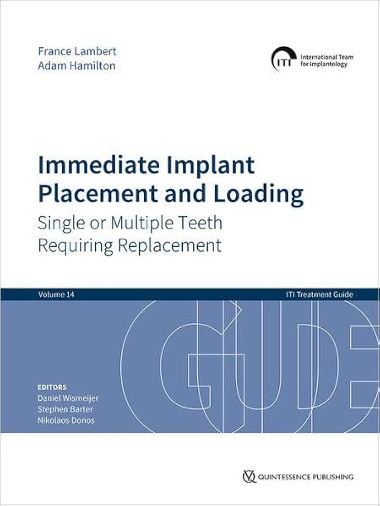 Immediate Implant Placement and Loading