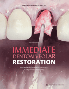 1.Immediate Dentoalveolar Restoration