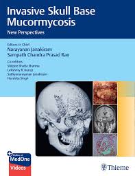 13.Invasive Skull Base Mucormycosis