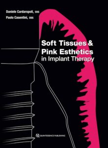 2.Soft Tissues and Pink Esthetics in Implant Therapy